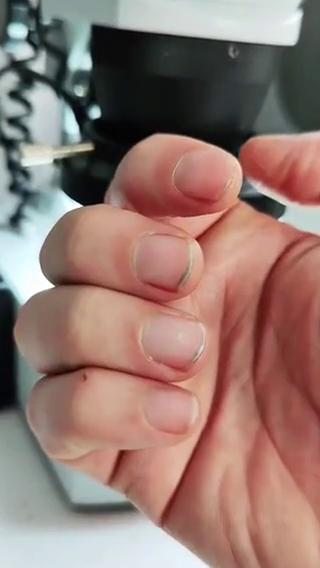 Áp phích cho 震惊！用显微镜看下指甲缝里的东西
