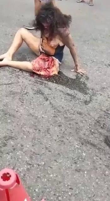 这腿应该是被霰弹枪打爆开了‘ 포스터